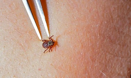 Lyme Disease on the Rise: Symptoms Often Elusive